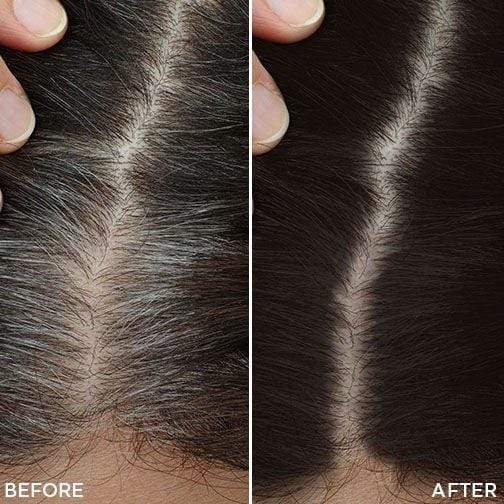 Toppik Root Touch Up Spray Castano Chiaro Ritocco Ricrescita 79gr - immagine 2
